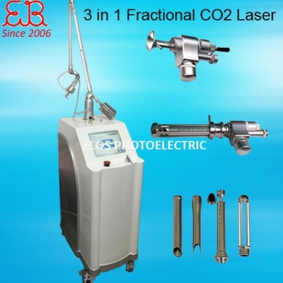 Fractional CO2 Laser for Scar Removal